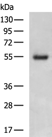 Gel: 8%SDS-PAGE Lysate: 40 microg Lane: Human liver cancer tissue Primary antibody: TA322904 (SPAG4 Antibody) at dilution 1/1000 Secondary antibody: Goat anti rabbit IgG at 1/5000 dilution Exposure time: 4 minutes