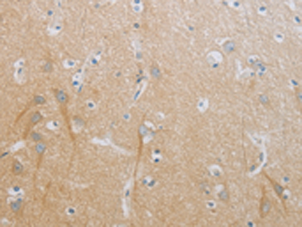 Immunohistochemistry of paraffin-embedded Human brain tissue using TA322995 (TNFRSF11B Antibody) at dilution 1/20 (Original magnification: x200)