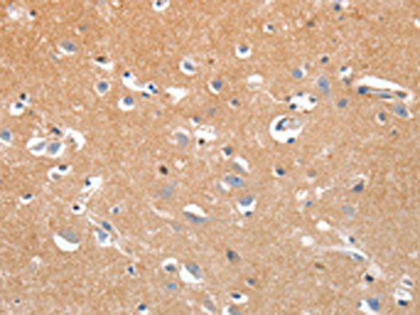 Immunohistochemistry of paraffin-embedded Human brain tissue using TA323023 (LRP3 Antibody) at dilution 1/80 (Original magnification: x200)