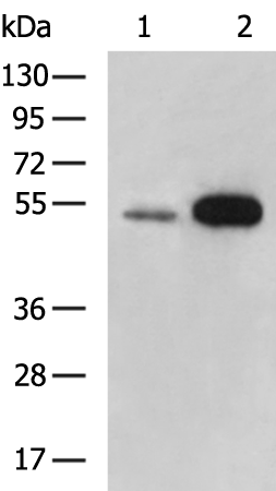 Gel: 8%SDS-PAGE Lysate: 40 microg Lane 1-2: Human uterus tissue Mouse testis tissue lysates Primary antibody: TA323429 (AADACL4 Antibody) at dilution 1/250 Secondary antibody: Goat anti rabbit IgG at 1/5000 dilution Exposure time: 5 minutes
