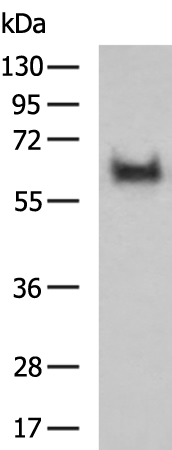 Gel: 8%SDS-PAGE Lysate: 40 microg Lane: TM4 cell lysate Primary antibody: TA323490 (DAZ4 Antibody) at dilution 1/700 Secondary antibody: Goat anti rabbit IgG at 1/5000 dilution Exposure time: 15 seconds