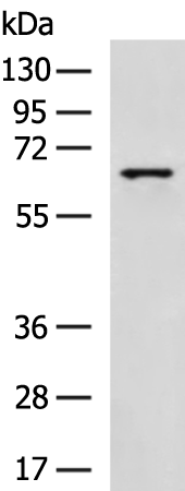 Host: Rabbit Target Name: Rhox8 Sample Type: Mouse Testis lysates Antibody Dilution: 1.0ug/ml