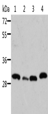Gel: 10%SDS-PAGE Lysate: 40 microg Lane 1-4: Mouse pancreas tissue Mouse spleen tissue mouse heart tissue 293T cells Primary antibody: TA324160 (STRADB Antibody) at dilution 1/500 Secondary antibody: Goat anti rabbit IgG at 1/8000 dilution Exposure time: 10 minutes