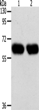 Gel: 10%SDS-PAGE Lysate: 40 microg Lane 1-2: Lncap cells SKOV3 cells Primary antibody: TA324206 (SYT7 Antibody) at dilution 1/200 Secondary antibody: Goat anti rabbit IgG at 1/8000 dilution Exposure time: 1 minute