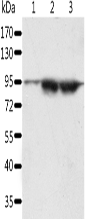 Gel: 10%SDS-PAGE Lysate: 60 microg Lane 1-3: A549 cells lncap cells human seminoma tissue Primary antibody: TA324241 (SPATA20 Antibody) at dilution 1/1000 Secondary antibody: Goat anti rabbit IgG at 1/8000 dilution Exposure time: 5 minutes