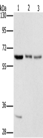 Gel: 8%SDS-PAGE Lysate: 40 microg Lane 1-3: 293T cells hela cells PC3 cells Primary antibody: TA349454 (AAAS Antibody) at dilution 1/400 Secondary antibody: Goat anti rabbit IgG at 1/8000 dilution Exposure time: 10 seconds