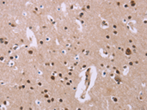 Immunohistochemistry of paraffin-embedded Human brain tissue using TA349469 (ANLN Antibody) at dilution 1/20 (Original magnification: x200)