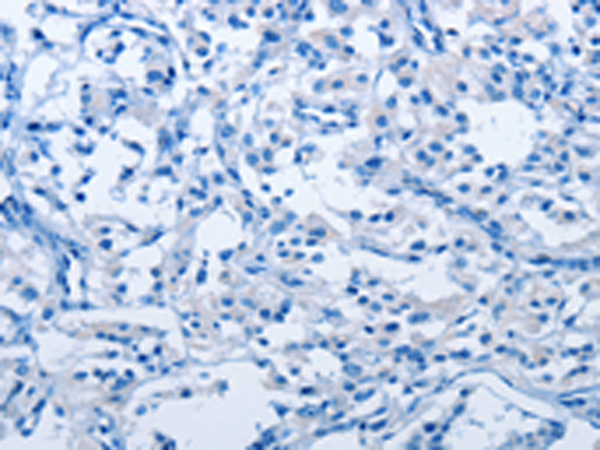SLAMF8 Rabbit Polyclonal Antibody – TA349714 | OriGene