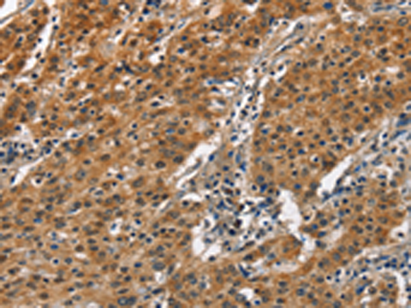 SLAMF8 Rabbit Polyclonal Antibody – TA349714 | OriGene