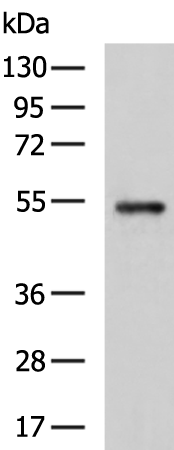 Gel: 8%SDS-PAGE Lysate: 40 microg Lane: Mouse brain tissue lysate Primary antibody: TA349727 (C3AR1 Antibody) at dilution 1/800 Secondary antibody: Goat anti rabbit IgG at 1/5000 dilution Exposure time: 40 seconds