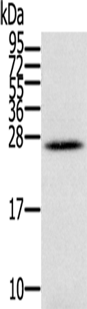 Gel: 12%SDS-PAGE Lysate: 40 microg Lane: Human ovarian cancer tissue Primary antibody: TA350088 (IFNL3 Antibody) at dilution 1/350 Secondary antibody: Goat anti rabbit IgG at 1/8000 dilution Exposure time: 1 minute