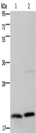 Gel: 10%SDS-PAGE Lysate: 40 microg Lane 1-2: Jurkat cells PC3 cells Primary antibody: TA350160 (MCTS1 Antibody) at dilution 1/200 Secondary antibody: Goat anti rabbit IgG at 1/8000 dilution Exposure time: 1 minute