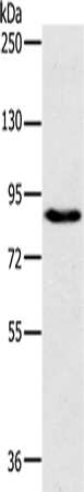 Gel: 6%SDS-PAGE Lysate: 40 microg Lane: 231 cells Primary antibody: TA350195 (PLEKHG6 Antibody) at dilution 1/800 Secondary antibody: Goat anti rabbit IgG at 1/8000 dilution Exposure time: 10 seconds
