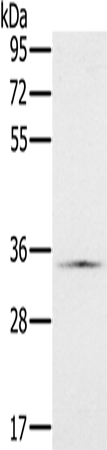 Western blot analysis of extracts of 293T cells, using MTA2 antibody (TA378718) at 1:1000 dilution.|Secondary antibody: HRP Goat Anti-Rabbit IgG (H+L) at 1:10000 dilution.|Lysates/proteins: 25ug per lane.|Blocking buffer: 3% nonfat dry milk in TBST.|Detection: ECL Basic Kit .|Exposure time: 1s.