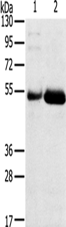 Gel: 8%SDS-PAGE Lysate: 40 microg Lane 1-2: Human placenta tissue Human stomach cancer tissue Primary antibody: TA350387 (SAMD3 Antibody) at dilution 1/400 Secondary antibody: Goat anti rabbit IgG at 1/8000 dilution Exposure time: 4 minutes
