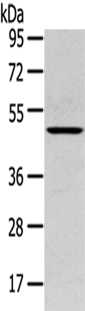 Gel: 8%SDS-PAGE Lysate: 40 microg Lane: Mouse lung tissue Primary antibody: TA350409 (SERPINB11 Antibody) at dilution 1/400 Secondary antibody: Goat anti rabbit IgG at 1/8000 dilution Exposure time: 30 seconds