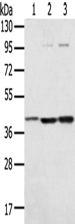 Gel: 8%SDS-PAGE Lysate: 40 microg Lane 1-3: Hepg2 cells TM4 cells Raw264.7 cells Primary antibody: TA350473 (STX18 Antibody) at dilution 1/300 Secondary antibody: Goat anti rabbit IgG at 1/8000 dilution Exposure time: 20 seconds