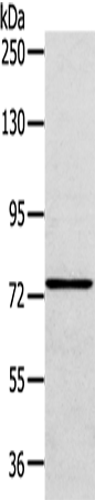Gel: 6%SDS-PAGE Lysate: 40 microg Lane: A172 cell Primary antibody: TA350607 (VPS53 Antibody) at dilution 1/200 Secondary antibody: Goat anti rabbit IgG at 1/8000 dilution Exposure time: 30 seconds