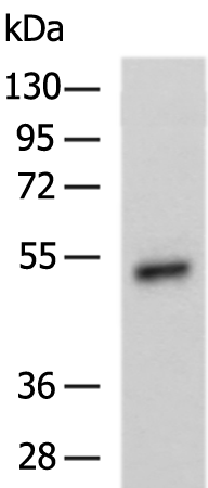 Gel: 8%SDS-PAGE Lysate: 40 microg Lane: Human placenta tissue lysate Primary antibody: TA350685 (SLC2A12 Antibody) at dilution 1/500 Secondary antibody: Goat anti rabbit IgG at 1/5000 dilution Exposure time: 10 minutes