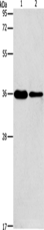 Gel: 12%SDS-PAGE Lysate: 40 microg Lane 1-2: A549 cells NIH/3T3 cells Primary antibody: TA350792 (AIMP2 Antibody) at dilution 1/200 Secondary antibody: Goat anti rabbit IgG at 1/8000 dilution Exposure time: 10 seconds