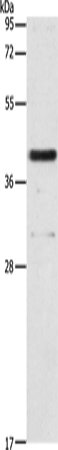Western blot analysis of extracts of normal 293T cells and 293T transfected with NSP16 Protein, using SARS-CoV-2 NSP16 antibody (TA379339) at 1:5000 dilution.|Secondary antibody: HRP Goat Anti-Rabbit IgG (H+L) at 1:10000 dilution.|Lysates/proteins: 25ug per lane.|Blocking buffer: 3% nonfat dry milk in TBST.|Detection: ECL Basic Kit .|Exposure time: 1s.
