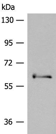 Western blot analysis of extracts of normal 293T cells and 293T transfected with NSP2 Protein, using SARS-CoV-2 NSP2 antibody (TA379340) at 1:5000 dilution.|Secondary antibody: HRP Goat Anti-Rabbit IgG (H+L) at 1:10000 dilution.|Lysates/proteins: 25ug per lane.|Blocking buffer: 3% nonfat dry milk in TBST.|Detection: ECL Basic Kit .|Exposure time: 5s.
