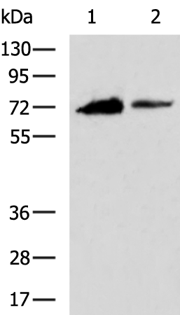 Western blot analysis of extracts of 293T cells, using SARS-CoV-2 ORF6  antibody (TA379501) at 1:1000 dilution.|Secondary antibody: HRP Goat Anti-Rabbit IgG (H+L) at 1:10000 dilution.|Lysates/proteins: 25ug per lane.|Blocking buffer: 3% nonfat dry milk in TBST.|Detection: ECL Basic Kit .|Exposure time: 180s.