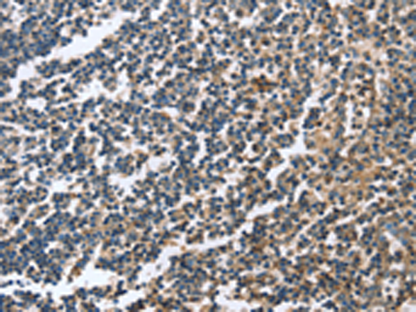 Immunohistochemistry of paraffin-embedded Human tonsil tissue using TA351026 (CAGE1 Antibody) at dilution 1/20 (Original magnification: x200)