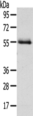 Gel: 8%SDS-PAGE Lysate: 40 microg Lane: Human normal liver tissue Primary antibody: TA351066 (NUF2 Antibody) at dilution 1/200 Secondary antibody: Goat anti rabbit IgG at 1/8000 dilution Exposure time: 1 minute
