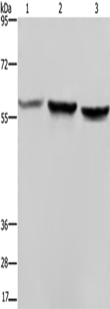 Gel: 6%SDS-PAGE Lysate: 40 microg Lane 1-3: Hela cells A375 cells LoVo cells Primary antibody: TA351289 (SYN2 Antibody) at dilution 1/1400 Secondary antibody: Goat anti rabbit IgG at 1/8000 dilution Exposure time: 40 seconds