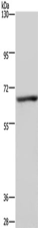 Gel: 6%SDS-PAGE Lysate: 40 microg Lane: Human fetal liver tissue Primary antibody: TA351313 (KCND1 Antibody) at dilution 1/300 Secondary antibody: Goat anti rabbit IgG at 1/8000 dilution Exposure time: 5 seconds