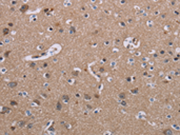 Immunohistochemistry of paraffin-embedded Human brain tissue using TA351466 (SH2D3A Antibody) at dilution 1/40 (Original magnification: x200)