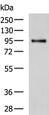 Gel: 8%SDS-PAGE Lysate: 40 microg Lane: Mouse brain tissue lysate Primary antibody: TA351519 (PPARGC1A Antibody) at dilution 1/800 Secondary antibody: Goat anti rabbit IgG at 1/5000 dilution Exposure time: 1 minute