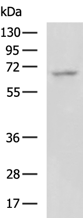 Gel: 8%SDS-PAGE Lysate: 40 microg Lane: Human placenta tissue lysate Primary antibody: TA351549 (POU6F2 Antibody) at dilution 1/800 Secondary antibody: Goat anti rabbit IgG at 1/5000 dilution Exposure time: 3 minutes