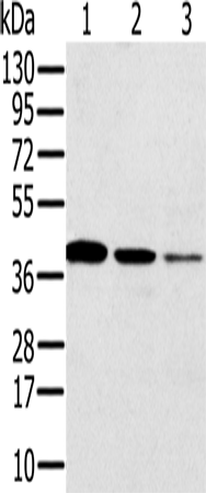 Gel: 12%SDS-PAGE Lysate: 40 microg Lane 1-3: Jurkat cells human seminoma tissue human liver cancer tissue Primary antibody: TA351636 (SYCP3 Antibody) at dilution 1/200 Secondary antibody: Goat anti rabbit IgG at 1/8000 dilution Exposure time: 40 seconds