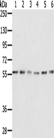 Gel: 8%SDS-PAGE Lysate: 40 microg Lane 1-6: K562 cells NIH/3T3 cells Jurkat cells 293T cells 231 cells hepg2 cells Primary antibody: TA351653 (SERINC2 Antibody) at dilution 1/200 Secondary antibody: Goat anti rabbit IgG at 1/8000 dilution Exposure time: 1 minute