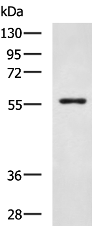 Gel: 8%SDS-PAGE Lysate: 40 microg Lane: Mouse pancreas tissue lysate Primary antibody: TA351678 (SLC16A10 Antibody) at dilution 1/600 Secondary antibody: Goat anti rabbit IgG at 1/5000 dilution Exposure time: 3 minutes