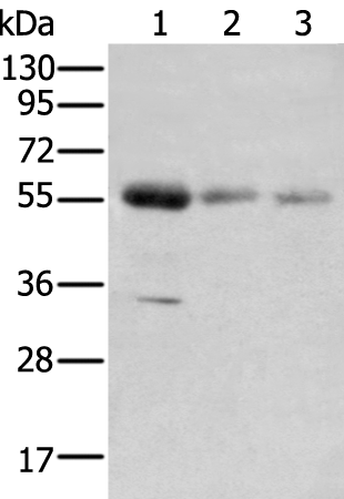 Western blot analysis of extracts of various cell lines, using PPAP2B antibody (TA380190) at 1:1000 dilution.|Secondary antibody: HRP Goat Anti-Rabbit IgG (H+L) at 1:10000 dilution.|Lysates/proteins: 25ug per lane.|Blocking buffer: 3% nonfat dry milk in TBST.|Detection: ECL Basic Kit .|Exposure time: 3s.
