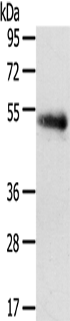 Gel: 8%SDS-PAGE Lysate: 40 microg Lane: 823 cells Primary antibody: TA351714 (SLC7A5 Antibody) at dilution 1/250 Secondary antibody: Goat anti rabbit IgG at 1/8000 dilution Exposure time: 2 minutes