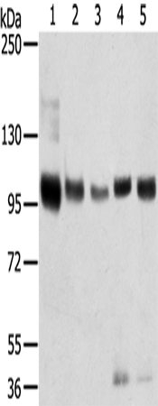 Western blot analysis of extracts of SW480 cells, using PP1 beta antibody (TA380232) at 1:1000 dilution.|Secondary antibody: HRP Goat Anti-Rabbit IgG (H+L) at 1:10000 dilution.|Lysates/proteins: 25ug per lane.|Blocking buffer: 3% nonfat dry milk in TBST.
