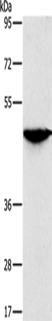 Western blot analysis of extracts from normal (control) and PPP1CC knockout (KO) HeLa cells, using PPP1CC antibody (TA380233) at 1:1000 dilution.|Secondary antibody: HRP Goat Anti-Rabbit IgG (H+L) at 1:10000 dilution.|Lysates/proteins: 25ug per lane.|Blocking buffer: 3% nonfat dry milk in TBST.|Detection: ECL Basic Kit .|Exposure time: 1s.