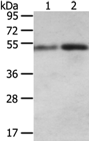 Gel: 8%SDS-PAGE Lysate: 80 microg Lane 1-2: Human colon cancer and normal stomach tissue Primary antibody: TA351777 (SNTA1 Antibody) at dilution 1/200 Secondary antibody: Goat anti rabbit IgG at 1/8000 dilution Exposure time: 1 minute