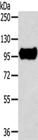 Gel: 6%SDS-PAGE Lysate: 40 microg Lane: Mouse brain tissue Primary antibody: TA351815 (TRIM71 Antibody) at dilution 1/300 Secondary antibody: Goat anti rabbit IgG at 1/8000 dilution Exposure time: 20 seconds