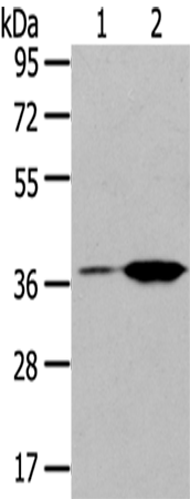 Gel: 8%SDS-PAGE Lysate: 40 microg Lane 1-2: Raji cells Jurkat cells Primary antibody: TA351878 (TBXA2R Antibody) at dilution 1/200 Secondary antibody: Goat anti rabbit IgG at 1/8000 dilution Exposure time: 40 seconds