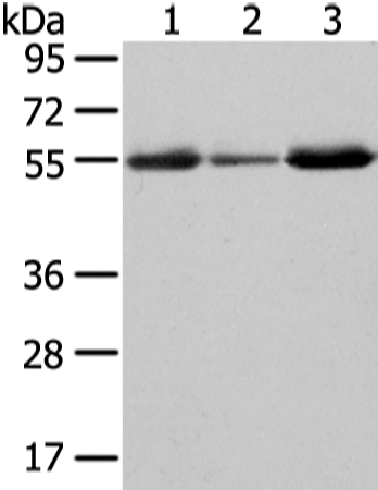 Gel: 8%SDS-PAGE Lysate: 40 microg Lane 1-3: Human thyroid cancer and liver cancer tissue human fetal intestines tissue Primary antibody: TA351964 (XKRX Antibody) at dilution 1/500 Secondary antibody: Goat anti rabbit IgG at 1/8000 dilution Exposure time: 2 minutes