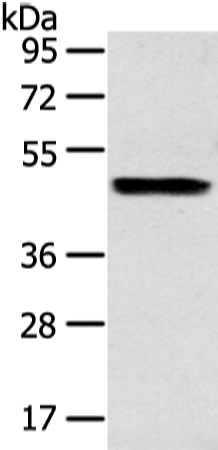 Gel: 8%SDS-PAGE Lysate: 40 microg Lane: Human liver cancer tissue Primary antibody: TA351973 (ZPR1 Antibody) at dilution 1/200 Secondary antibody: Goat anti rabbit IgG at 1/8000 dilution Exposure time: 15 seconds