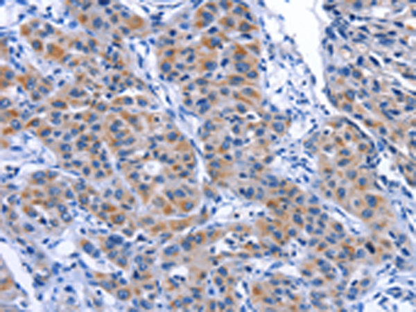 Immunohistochemistry on Paraffin Section of Human prostate