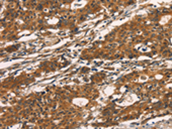 Formalin-Fixed, Paraffin-Embedded Human tonsil stained with CD74 Antibody (Clone LN2).