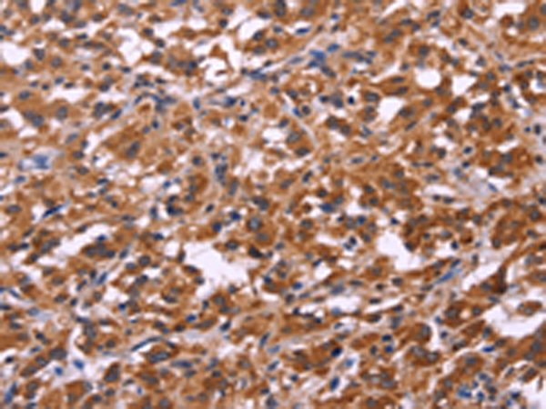 Western blot analysis of GFAP in Human brain lysate using GFAP Antibody (Clone GA5).