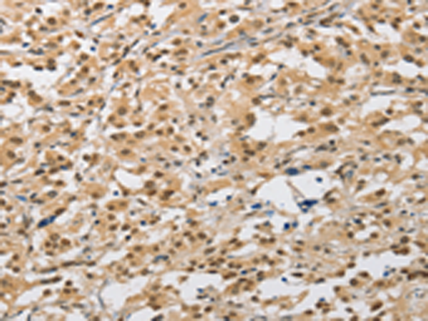 Formalin-Fixed, Paraffin-Embedded Human testis stained with MAGE-1 Antibody (Clone MA454).